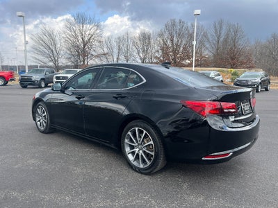 2015 Acura TLX V6 Tech